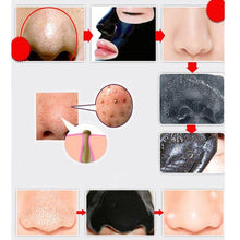 Load image into Gallery viewer, Amazing Blackhead Removal Deep Cleaning Face Mask It&#39;s WONDERFUL
